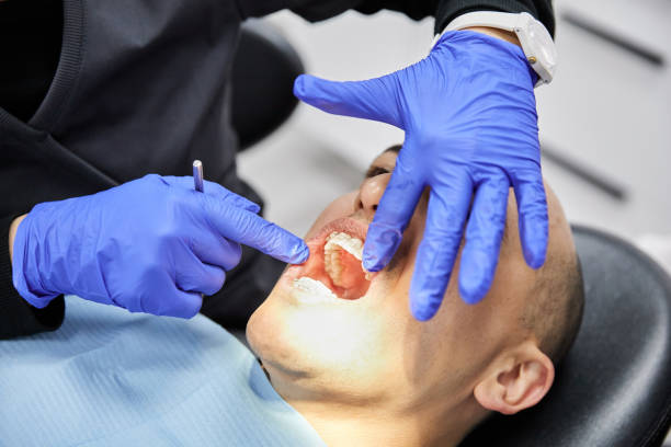 Best Cracked Tooth Emergency Dentist  in Marysville, WA